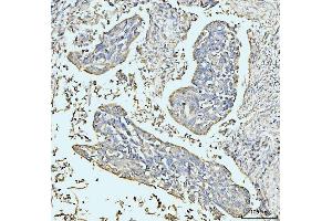 IHC analysis of GRPEL1 using anti-GRPEL1 antibody (ABIN7602643). (GRPEL1 anticorps  (AA 90-217))