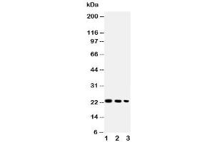 Western blot testing of BAFF antibody and Lane 1:  recombinant human protein 10ng (BAFF anticorps  (AA 265-285))