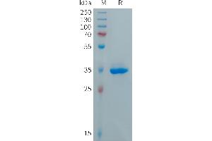 Chemokine (C-X-C Motif) Ligand 5 (CXCL5) protein (Fc Tag)