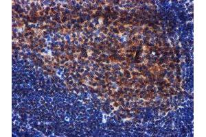 Image no. 2 for anti-PIH1 Domain Containing 2 (PIH1D2) (AA 1-315) antibody (ABIN1490740)