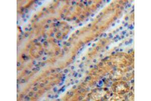 IHC-P analysis of kidney tissue, with DAB staining. (Tyrosine Hydroxylase anticorps  (AA 34-301))