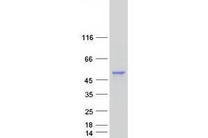Validation with Western Blot (GLA Protein (Myc-DYKDDDDK Tag))