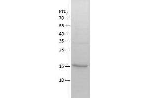 Western Blotting (WB) image for TP53RK Binding Protein (TPRKB) (AA 1-175) protein (His-IF2DI Tag) (ABIN7125422)