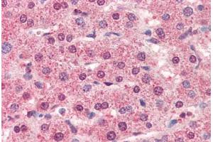 Human Liver (formalin-fixed, paraffin-embedded) stained with CTSL1 antibody ABIN364356 at 5 ug/ml followed by biotinylated anti-mouse IgG secondary antibody ABIN481714, alkaline phosphatase-streptavidin and chromogen. (Cathepsin L anticorps  (AA 114-333))