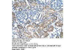 Immunohistochemistry (IHC) image for anti-Solute Carrier Family 38 Member 4 (SLC38A4) (Middle Region) antibody (ABIN2775452)