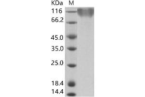 Western Blotting (WB) image for Epstein-Barr Virus Membrane Antigen gp350 (EBV gp350) protein (His tag) (ABIN7198937) (EBV-Gp350 Protein (His tag))