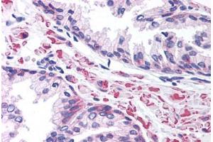 anti-Lymphoid Enhancer-Binding Factor 1 (LEF1) (AA 51-100) antibody