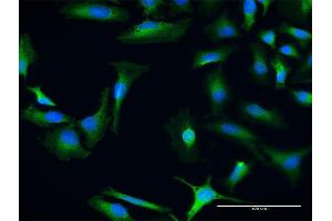 Immunofluorescence of purified MaxPab antibody to CHD9 on HeLa cell. (CHD9 anticorps  (AA 1-119))