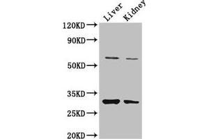 Western Blot Positive WB detected in: Mouse liver tissue, Mouse kidney tissue All lanes: PANK2 antibody at 3. (PANK2 anticorps  (AA 437-490))