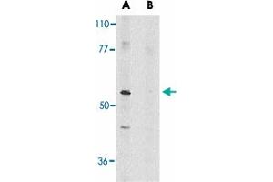 Western blot analysis of Ripk3 in mouse NIH/3T3 whole cell lysate in the absence (A) or presence (B) of blocking peptide with Ripk3 polyclonal antibody  at 1 ug/mL .
