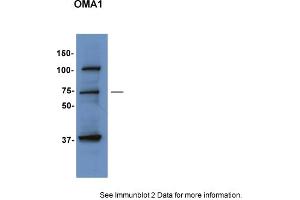 Sample Type: HepG2 cellsPrimary Dilution: 1:1000Secondary Antibody: anti-Rabbit TBST with 5% BSASecondary Dilution: 1:5000Image Submitted by: Hana SabicUniversity of Utah (OMA1 anticorps  (Middle Region))