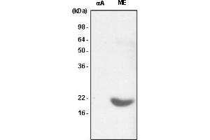 Western Blotting (WB) image for anti-Crystallin, alpha B (CRYAB) antibody (ABIN165394) (CRYAB anticorps)