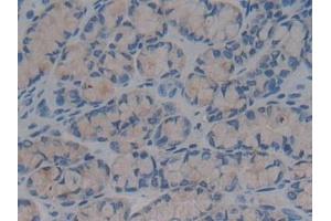 Detection of BPI in Mouse Colon Tissue using Polyclonal Antibody to Bactericidal/Permeability Increasing Protein (BPI)