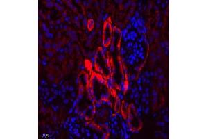 Immunofluorescence of paraffin embedded mouse kidney using SLC7A8 (ABIN7074503) at dilution of 1:300 (400x lens) (LAT2 anticorps)