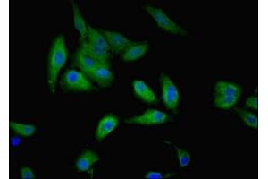 Immunofluorescent analysis of Hela cells using ABIN7174611 at dilution of 1:100 and Alexa Fluor 488-congugated AffiniPure Goat Anti-Rabbit IgG(H+L) (GALE anticorps  (AA 1-348))