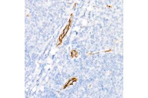 Immunohistochemistry of paraffin-embedded Human tonsil using von Willebrand factor (VWF) antibody (ABIN7271339) at dilution of 1:800 (40x lens). (VWF anticorps)