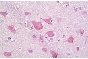 Anti-CSNK1E antibody IHC staining of human brain, cortex neurons. (CK1 epsilon anticorps  (AA 276-325))