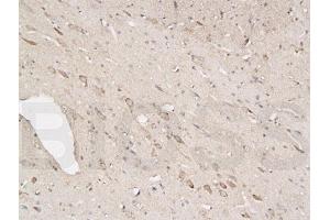 anti-Tyrosine Hydroxylase (TH) (AA 101-165) antibody