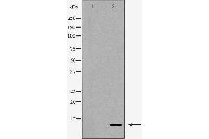 Western blot analysis of Hepg2 whole cell lysates, using SNRPE Antibody.