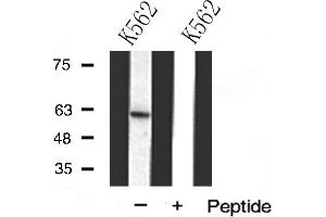Western blot analysis of DCT(TRP2) expression in K562 cells (DCT anticorps  (N-Term))