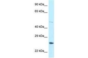 Image no. 1 for anti-Heterogeneous Nuclear Ribonucleoprotein F (HNRNPF) (AA 328-377) antibody (ABIN6747978) (HNRNPF anticorps  (AA 328-377))