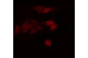 ABIN6275228 staining  HuvEc cells by IF/ICC. (CLNS1A anticorps  (C-Term))
