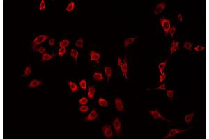 ABIN6266494 staining HeLa by IF/ICC. (MST1R anticorps  (C-Term))