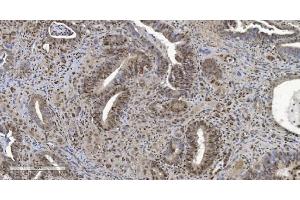 IHC analysis of HP1 alpha/CBX5 using anti-HP1 alpha/CBX5 antibody (ABIN7599057). (CBX5 anticorps  (AA 1-191))