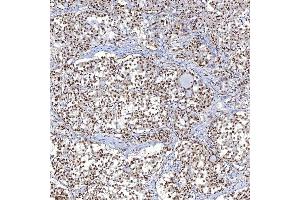 IHC analysis of TRMT61A using anti-TRMT61A antibody (ABIN7599220). (TRMT61A anticorps  (AA 1-289))