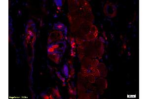Immunofluorescence (IF) image for anti-Hepatitis B Virus Surface Antigen (HBsAg) antibody (ABIN723066) (HBSAg anticorps)