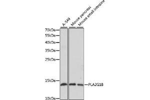 Western blot analysis of extracts of various cell lines, using PLG1B antibody (ABIN6129428, ABIN6145724, ABIN6145725 and ABIN6221143) at 1:1000 dilution. (PLA2G1B anticorps  (AA 23-148))