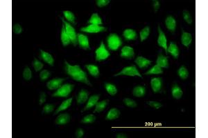 Immunofluorescence of monoclonal antibody to PYCRL on HeLa cell.