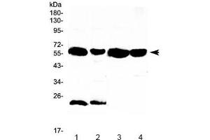 Western blot testing of 1) rat liver, 2) rat kidney, 3) mouse liver and 4) mouse kidney lysate with UGT1A1 antibody at 0.