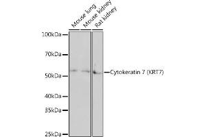 Western blot analysis of extracts of various cell lines, using Cytokeratin 7 (KRT7) (KRT7) Rabbit mAb  at 1:1000 dilution. (Cytokeratin 7 anticorps)