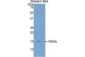 Western blot analysis of the recombinant protein. (INHBC anticorps  (AA 237-352))