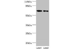 Western blot All lanes: GALNT14 antibody at 2 μg/mL Lane 1: Rat gonad tissue Lane 2: Mouse kidney tissue Secondary Goat polyclonal to rabbit IgG at 1/10000 dilution Predicted band size: 65, 61, 62 kDa Observed band size: 65 kDa (GALNT14 anticorps  (AA 1-552))
