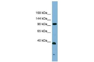 ERCC4 antibody used at 1 ug/ml to detect target protein. (ERCC4 anticorps  (Middle Region))