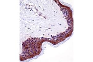 Immunohistochemistry analysis in formalin fixed and paraffin embedded human skin tissue reacted with LSM14A Antibody (C-term) followed which was peroxidase conjugated to the secondary antibody and followed by DAB staining.