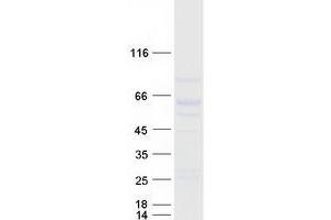 Validation with Western Blot