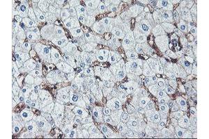 Immunohistochemical staining of paraffin-embedded Human liver tissue using anti-NPTN mouse monoclonal antibody. (NPTN anticorps)