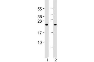 Western blot testing of 1) human skeletal muscle and 2) rat skeletal muscle lysate with MYL1 antibody at 1:2000. (MYL1 anticorps  (AA 24-58))