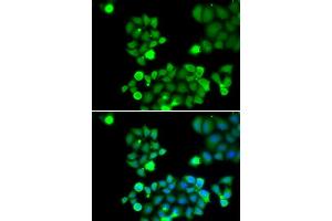Immunofluorescence analysis of HeLa cells using NEIL1 antibody (ABIN5973442). (NEIL1 anticorps)