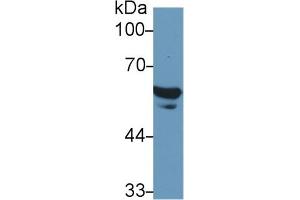 Detection of FGB in Human Serum using Polyclonal Antibody to Fibrinogen Beta Chain (FGB) (Fibrinogen beta Chain anticorps  (AA 29-118))