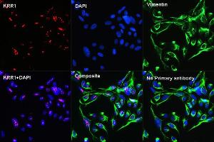 Confocal Immunofluorescent analysis of U2OS cells using KRR1 Rabbit pAb  at dilution of 1:100 (40x lens)(red).