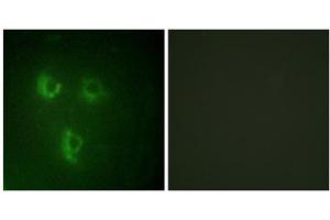 Immunofluorescence analysis of HUVEC cells, using TMEPA antibody. (PMEPA1 anticorps  (Internal Region))