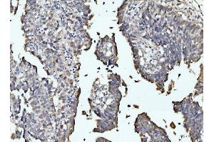 IHC analysis of RRP4/EXOSC2 using anti-RRP4/EXOSC2 antibody (ABIN7602188). (EXOSC2 anticorps  (AA 62-293))