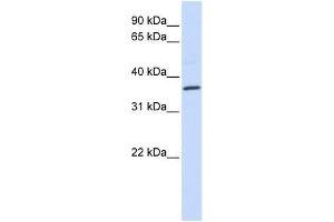 CCR5 antibody used at 5 ug/ml to detect target protein. (CCR5 anticorps  (Middle Region))