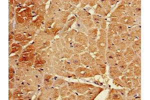 Immunohistochemistry of paraffin-embedded human heart tissue using ABIN7145367 at dilution of 1:100 (B3GALT2 anticorps  (AA 201-422))