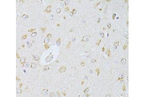 Immunohistochemistry of paraffin-embedded Rat brain using NTS Polyclonal Antibody at dilution of 1:100 (40x lens). (Neurotensin anticorps)
