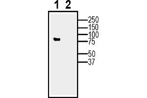 Expression of Calnexin in  cells (lane 1) and in -derived exosomes (lane 2). (Calnexin (CANX) Peptide)